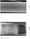 Fig. 05 - Systems and methods for multi-modal sensing of depth in vision systems for automated surgical robots
