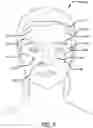 Fig. 05 - Real-time surgical reference indicium apparatus and methods for surgical applications
