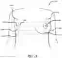 Fig. 09 - Real-time surgical reference indicium apparatus and methods for surgical applications