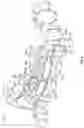Fig. 12 - DENTAL RESTORATION MOLDS