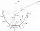 Fig. 01 - ORTHODONTIC ARCHWIRE