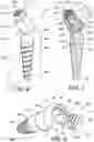 Fig. 05 - DENTAL IMPLANT