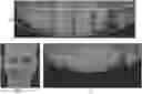 Fig. 01 - COMPUTER IMPLEMENTED METHODS FOR DEFINING A DENTAL RESTORATION