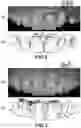 Fig. 03 - COMPUTER IMPLEMENTED METHODS FOR DEFINING A DENTAL RESTORATION