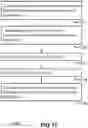 Fig. 11 - COMPUTER IMPLEMENTED METHODS FOR DEFINING A DENTAL RESTORATION