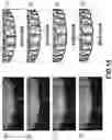 Fig. 15 - COMPUTER IMPLEMENTED METHODS FOR DEFINING A DENTAL RESTORATION