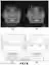 Fig. 16 - COMPUTER IMPLEMENTED METHODS FOR DEFINING A DENTAL RESTORATION