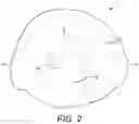 Fig. 03 - PROSTHETIC TOOTH
