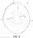 Fig. 06 - PROSTHETIC TOOTH