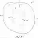 Fig. 09 - PROSTHETIC TOOTH