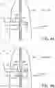 Fig. 05 - Irrigator fluidic communication