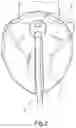 Fig. 03 - Protective Device, in Particular for a Dental Surgeon