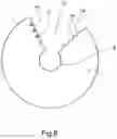 Fig. 06 - Protective Device, in Particular for a Dental Surgeon