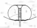 Fig. 05 - INTRAVESICULAR DEVICE FOR CONTROLLING URINARY INCONTINENCE