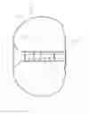 Fig. 06 - INTRAVESICULAR DEVICE FOR CONTROLLING URINARY INCONTINENCE