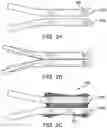 Fig. 04 - Systems and methods for mesh augmentation and prevention of incisional hernia