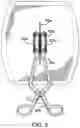 Fig. 08 - Systems and methods for mesh augmentation and prevention of incisional hernia