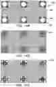 Fig. 15 - Systems and methods for mesh augmentation and prevention of incisional hernia