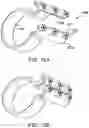 Fig. 17 - Systems and methods for mesh augmentation and prevention of incisional hernia