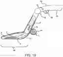 Fig. 22 - Systems and methods for mesh augmentation and prevention of incisional hernia