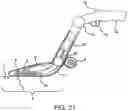 Fig. 24 - Systems and methods for mesh augmentation and prevention of incisional hernia