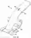 Fig. 40 - Systems and methods for mesh augmentation and prevention of incisional hernia