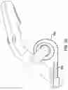Fig. 41 - Systems and methods for mesh augmentation and prevention of incisional hernia