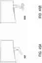 Fig. 49 - Systems and methods for mesh augmentation and prevention of incisional hernia
