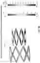 Fig. 11 - Mixed-Frame Intraluminal Prosthesis And Methods Thereof