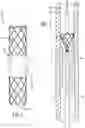 Fig. 02 - PULSATILE VASCULAR STENT GRAFT