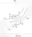 Fig. 22 - LIGAMENT REPAIR SYSTEM AND METHOD