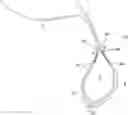 Fig. 01 - ADJUSTABLE SUTURE BUTTON CONSTRUCT
