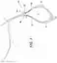 Fig. 02 - ADJUSTABLE SUTURE BUTTON CONSTRUCT