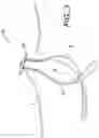 Fig. 04 - ADJUSTABLE SUTURE BUTTON CONSTRUCT