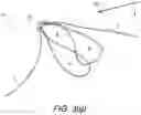 Fig. 08 - ADJUSTABLE SUTURE BUTTON CONSTRUCT