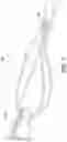 Fig. 15 - ADJUSTABLE SUTURE BUTTON CONSTRUCT