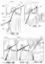 Fig. 26 - ADJUSTABLE SUTURE BUTTON CONSTRUCT