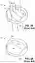 Fig. 03 - Trileaflet mechanical prosthetic heart valve