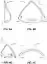 Fig. 06 - Trileaflet mechanical prosthetic heart valve