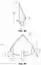 Fig. 07 - Trileaflet mechanical prosthetic heart valve