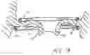 Fig. 10 - Device And Method For Improving The Function Of A Heart Valve