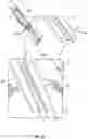 Fig. 17 - Device for Heart Repair