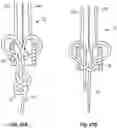 Fig. 27 - Device for Heart Repair