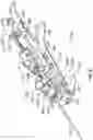 Fig. 31 - Device for Heart Repair