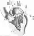 Fig. 16 - ANNULOPLASTY PROCEDURES, RELATED DEVICES AND METHODS