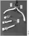 Fig. 32 - ANNULOPLASTY PROCEDURES, RELATED DEVICES AND METHODS