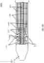 Fig. 10 - ANNULOPLASTY PROCEDURES, RELATED DEVICES AND METHODS