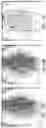 Fig. 23 - ANNULOPLASTY PROCEDURES, RELATED DEVICES AND METHODS