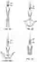Fig. 04 - Biased distal assemblies with locking mechanism