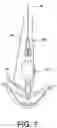 Fig. 08 - Biased distal assemblies with locking mechanism